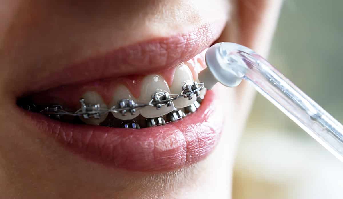 orthodontist near me braces